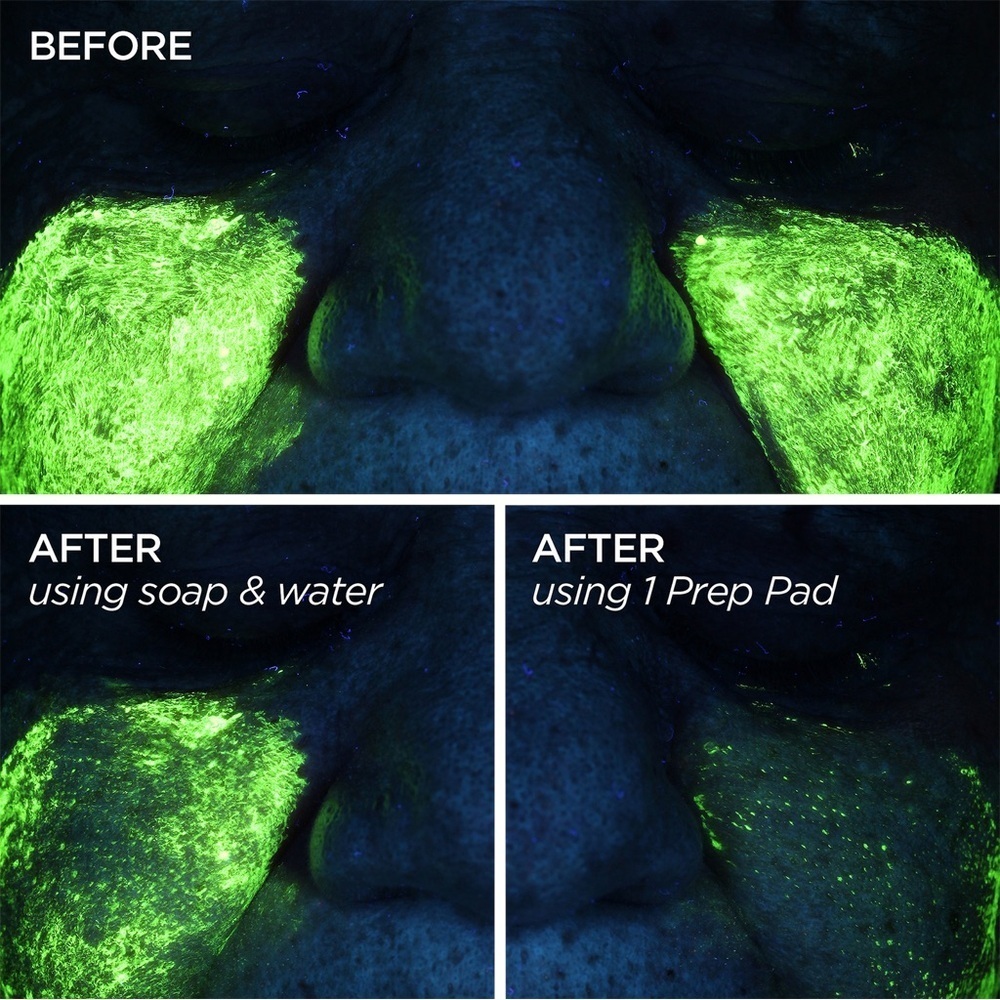 NEW Beauty Bio GloPRO Skin Pads Clarifying Cleansing Wipes w/Peptides~SEALED - Picture 5 of 9